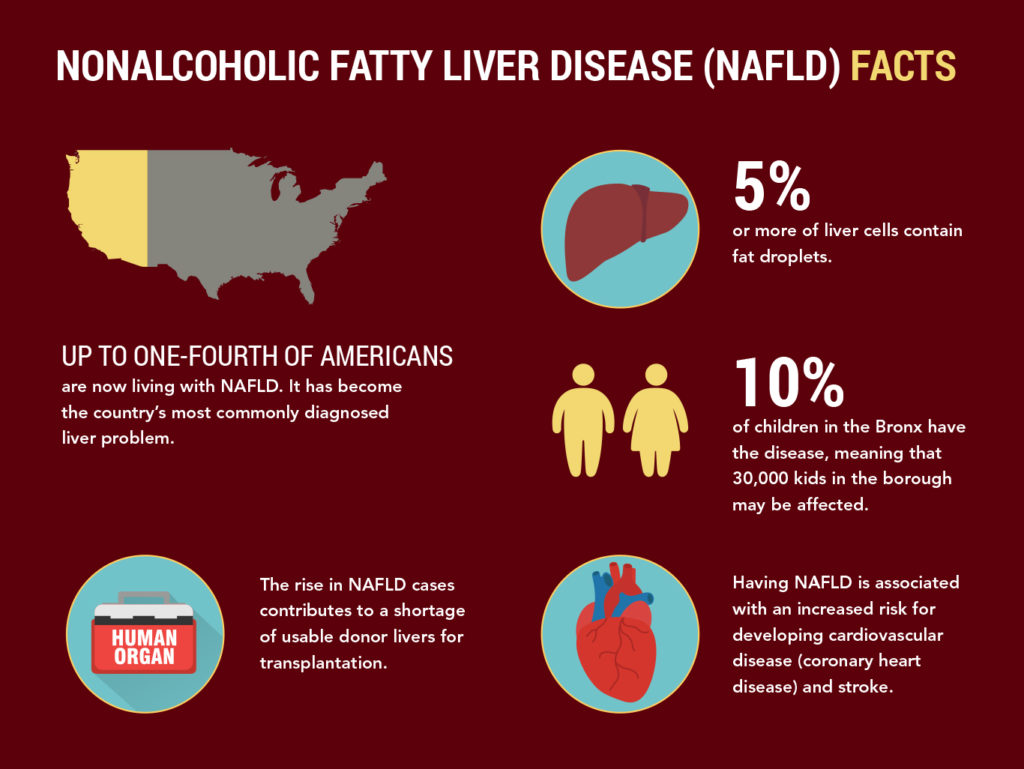 infographic-NAFLD-facts Fatty Liver