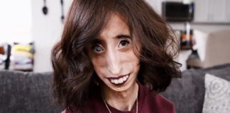 Lizzie Velazquez is the Anti-Bullying Ball Buster We Need Lizzie Velasquez BELatina